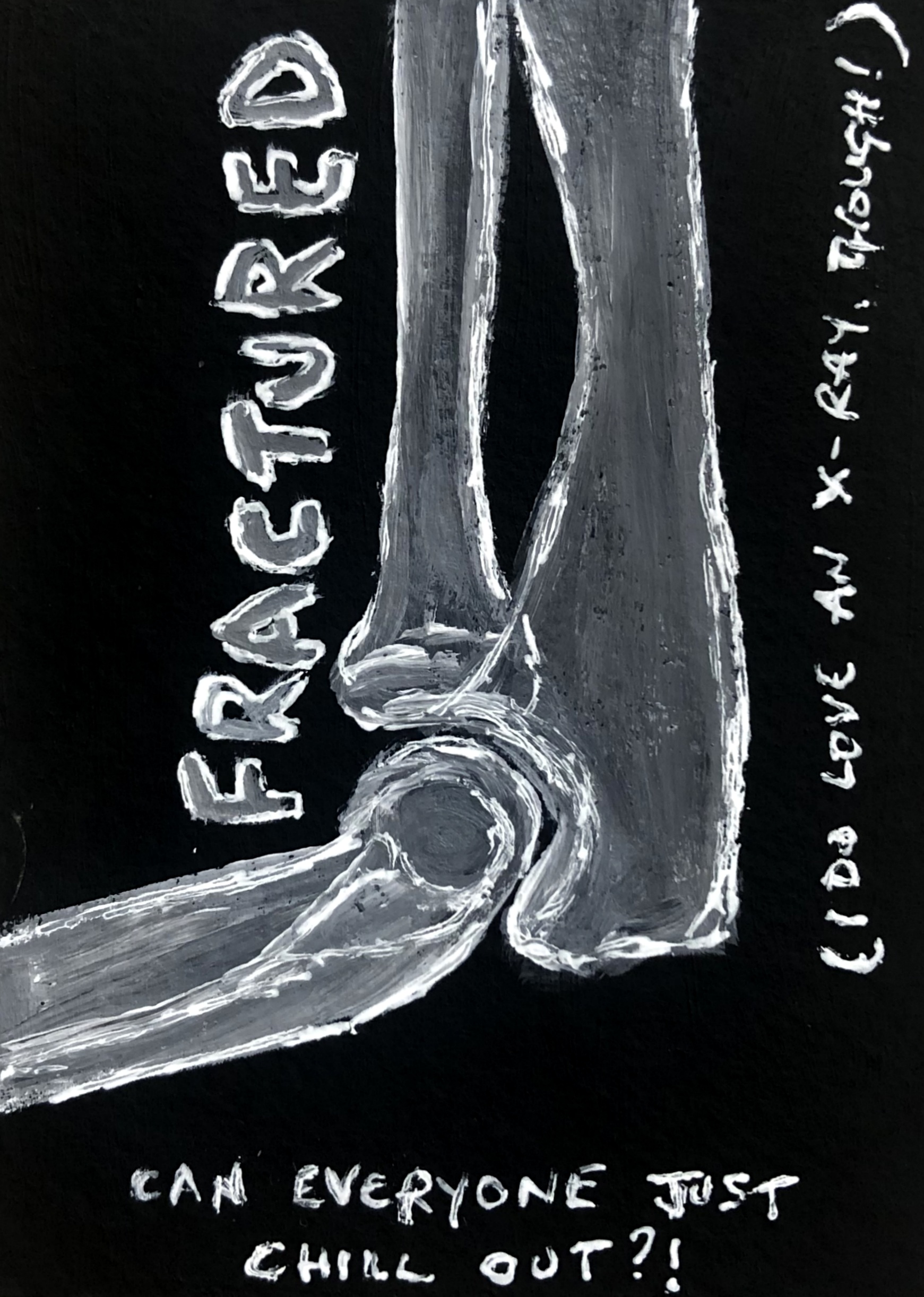 An illustration of an x-ray of a fractured elbow with some thoughts written around it.